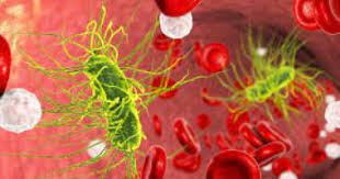 See blood poisoning stock video clips. Symptoms Of Blood Poisoning And Ways To Prevent It After Yasmin Abdel Aziz S Disease Jnews