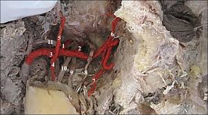 Middle meningeal artery — noun branch of the maxillary artery; Right Infratemporal Fossa 1 Middle Meningeal Artery 2 Accessory Download Scientific Diagram