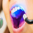 Tooth Laser Filling product image