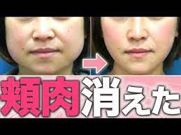 頬肉 たるみ 法令線が消える バッカルファット解消法 youtube 2021 フェイスケア 寝る前 ダイエット 顔のエクササイズ