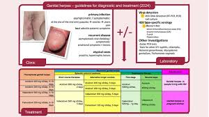 Image result for genital herpes