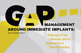 Latest procurement and supply chain news, opinion, analysis and jobs from supply management. Gap Management Around Immediate Implants By Dr Dale Rosenbach Dentaltown