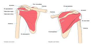 Bigliani analysierte retrospektiv 25 schultern mit knöchernen bankart läsionen und unterteilte diese in drei typen 1. Impingement Syndrom Schulter Ausg 13 Klinik Am Ring
