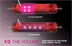 Bayer In Radiology Gadavist Gadobutrol Injection 1 Mmol Ml