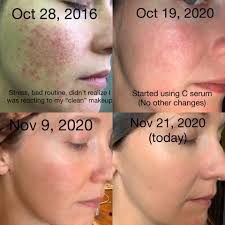 What are your thoughts