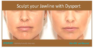 Botox injections into the jaw are also called masseter botox, named after the masseter muscle in the lower half of the face. Botox For Jaw Pain Plano Tx Teeth Grinding Frisco Tx