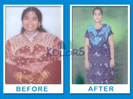 Pin On Weight Loss Service In Chennai