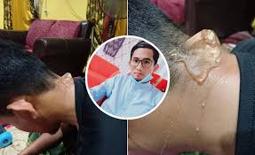 Kabar baiknya adalah ada beberapa hal sederhana yang dapat anda lakukan untuk meringankan rasa sakit tanpa. Ustaz Ini Ajar Cara Hilangkan Sakit Kepala Dengan Letakkan Ais Batu Maskulin