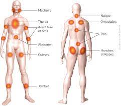 Fibromyalgie ist leider ein weit verbreitetes problem, das 3,5 millionen menschen, oder 1 in fünf menschen betrifft. Fibromyalgie Definition Symptomes Diagnostic Et Traitement