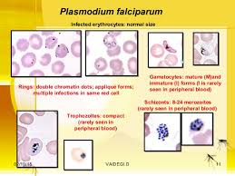 The three less common and less dangerous plasmodium. Laboratory Diagnosis Of Malarial Parasite