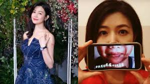 Michelle Chen Was Raising Awareness For Abused Children But Got Slammed For  Editing Her Photos Instead