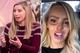 Woman who suffered 96 per cent burns in holiday coach crash reveals video  message Katie Piper sent her