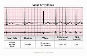 Ekg Ecg Interpretation Course Ceufast Nursing Continuing