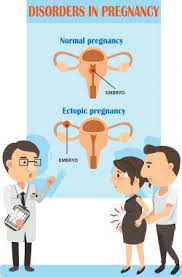 Menstrual Cramps During Pregnancy Lovetoknow