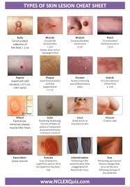 Skin Lesions Home Health Care Nursing School Tips Nclex