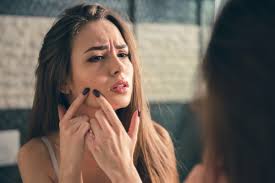 Feb 09, 2018 · once you've found your spackle, use a small brush, like a precision eyeliner brush, to cover both the whitehead and the red, inflamed area surrounding it. How To Cover Up A Pimple Without Makeup Fine Feather Heads