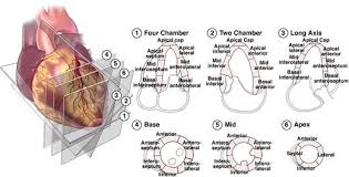 Validate User In 2020 Medical Ultrasound Cardiac Sonography Echocardiogram