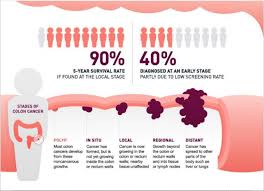You have no symptoms when you have stage i or stage ii colon cancer, so screenings are essential. Early Simptoms Of Colon Cancer International Surgery Rome