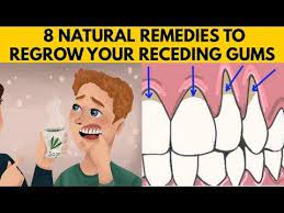 20 8 Easy Ways To Grow Back Your Receding Gums Naturally At Home Youtube Receding Gums Receeding Gums Teeth Health