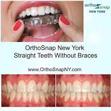Orthosnapnewyork Http Www Orthosnapny Com Dr Irina Feldbein Manhattan And Brooklyn 1 844 678 4676 Straight Teeth Beautiful Smile Perfect Teeth