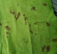 Could someone help me how to remove blood stains from cloth ...