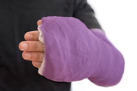 Image result for Hand Fracture