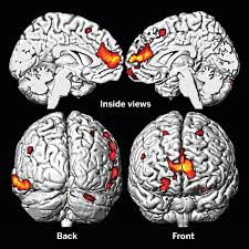 Image result for Lead Poisoning