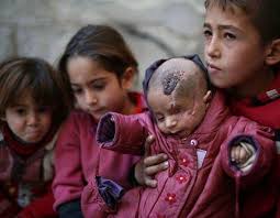 Syria intense bombing in the syrian province of idlib left a father scrambling to rescue his children while his baby daughter dangled off the edge of a destroyed building. World Shows Support For Syrian Baby Who Lost An Eye In Bombing Middle East Eye