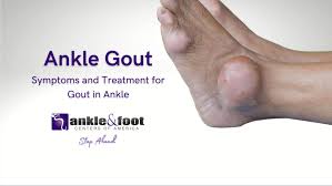 Image result for gout
