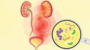 Check spelling or type a new query. Urinary Tract Infections Or Utis What To Know About Symptoms Treatment Prevention Everyday Health