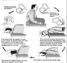 Dieses manöver ist von dr. Pdf Comparison Between Efficacy Of Epley S Maneuver With Medical Therapy Versus Medical Therapy Alone In Treating Bppv Patients Semantic Scholar