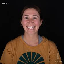 Blue Door Dental Design // Dr. Robin Bethell (@robinbethelldds) • Instagram  photos and videos