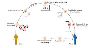 This article explores the process of transplantation, how to choose a donor, and the risks involved with such a procedure. Hematopoietic Stem Cell Surface Marker Cusabio