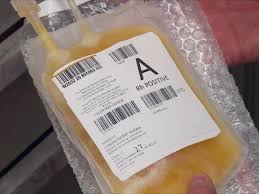 Image result for Plasma Transfusion