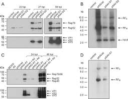 Image result for Black 1996 AAV