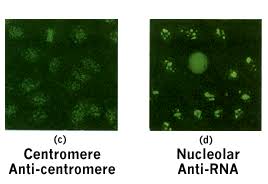 Image result for ANA Staining Pattern