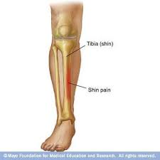 Pin On Soccer Injuries