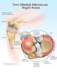 Pin On Bodybuilding Tips