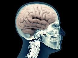 Feb 05, 2016 · occasionally, you won't feel any initial symptoms. Brain Bleed Symptoms Causes Treatment Complications And Outlook