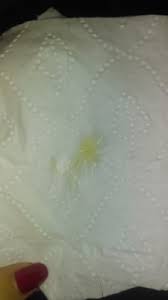 Flujo Vaginal Porque Tengo Un Flujo Amarillo Sin Olor