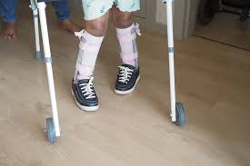 Image result for Orthotic