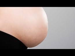 How To Remove Stretch Marks In Photoshop Photoshop Photoshop Tips Photoshop Tutorial