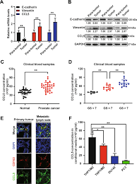 Ccl5 Derived From Tumor Associated Macrophages Promotes Prostate Cancer Stem Cells And Metastasis Via Activating B Catenin Stat3 Signaling Cell Death Disease