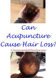 Pin On Hair Loss Remedy