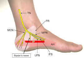Check spelling or type a new query. Guiding Treatment For Foot Pain Physical Medicine And Rehabilitation Clinics