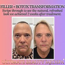 Ultimate Beauty Medspa