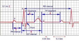 Image result for Electrocardiogram Validity