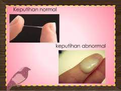 Perdarahan yang terjadi di luar masa menstruasi. Obat Keputihan Keputihan Bercampur Darah Bahayakah Facebook
