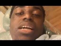 This was an ongoing course of treatment involving bone. Kodak Black Gets Permanent Gold Teeth Removed Xxl