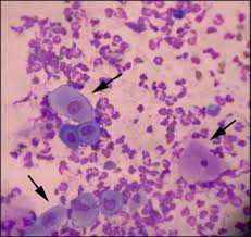 It's part of a family of rare skin conditions called pemphigus that produce blisters or sores on the skin, in the mouth, or on the genitals. Pemphigus Foliaceus In A Cat Veterian Key